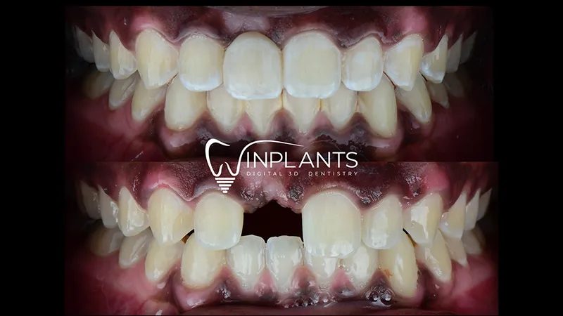 Before and after gallery