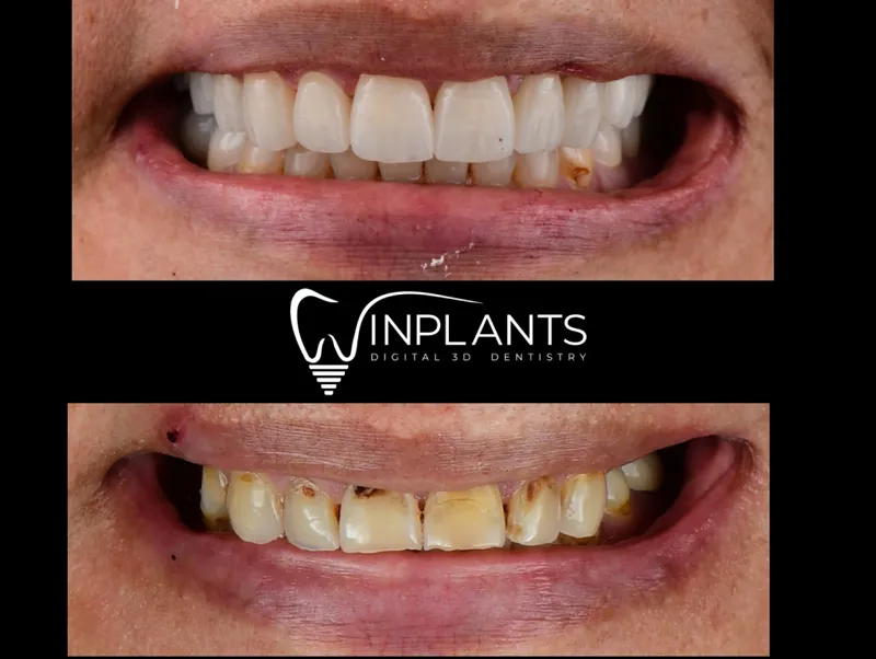 Before and after gallery