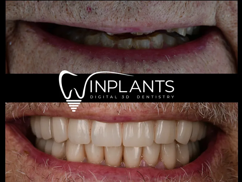 Before and after gallery