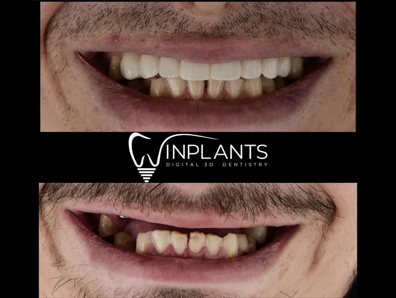 Before and after gallery