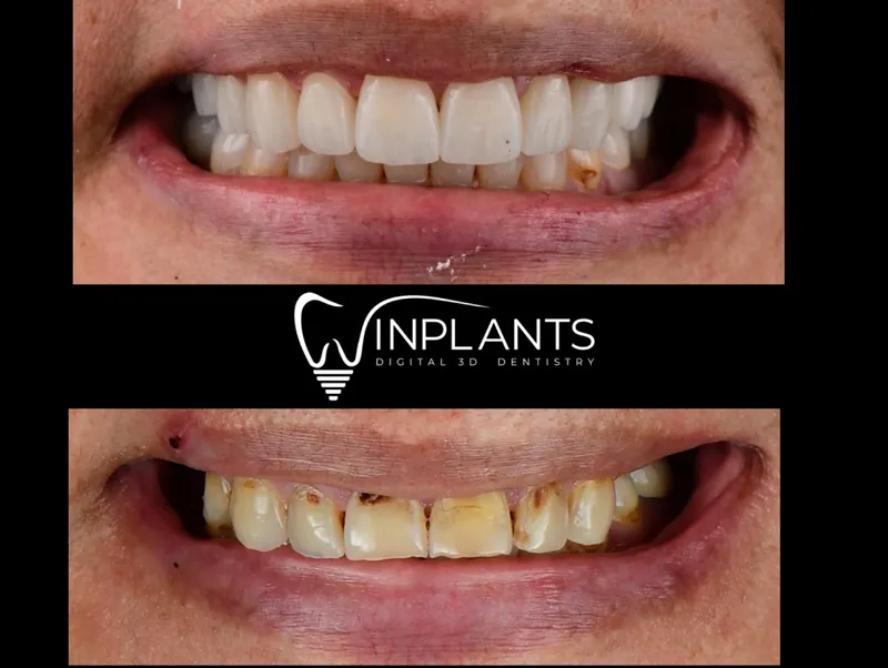 Before and after gallery