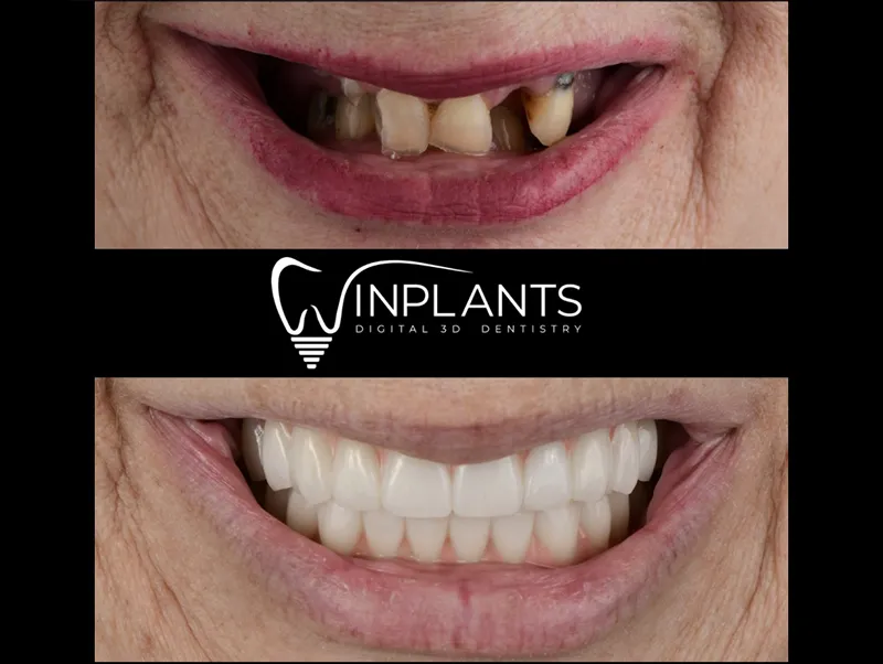 Before and after gallery