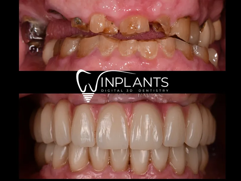 Before and after gallery